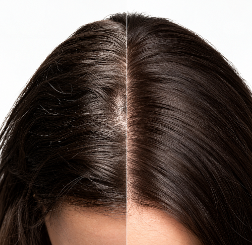 Шампунь против перхоти - Goldwell Dualsenses Scalp Specialist Anti-Dandruff Shampoo